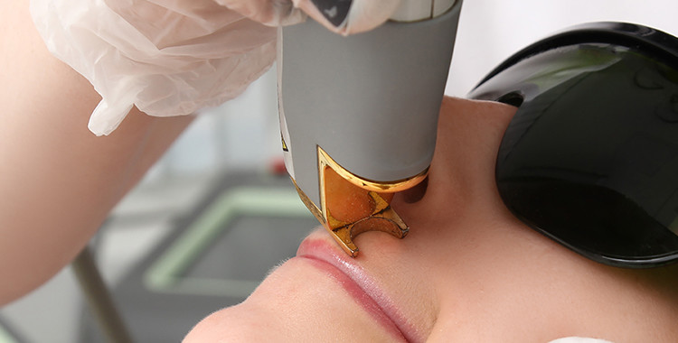 HairRemoval